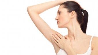 excessive underarm sweating